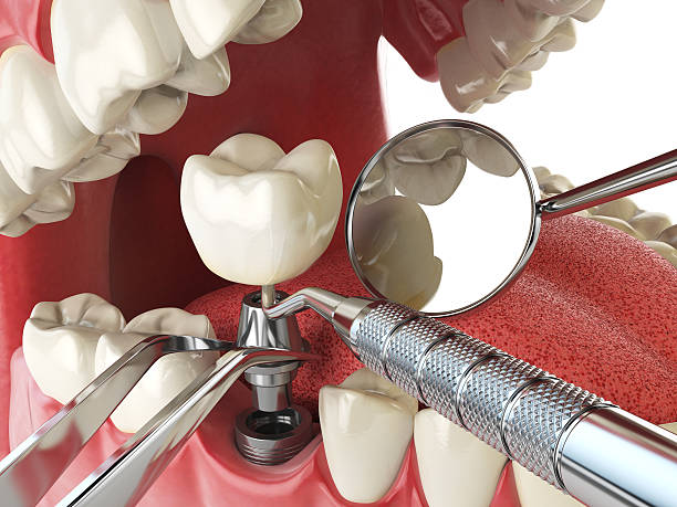 Best Emergency Treatment for Oral Infections in Hilton, NY